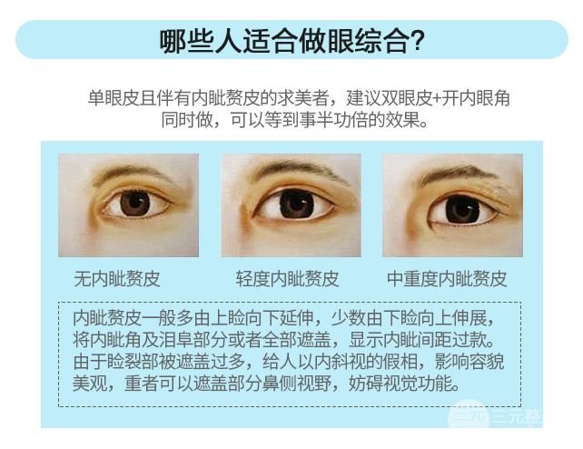 做双眼皮多项整形有什么优缺点