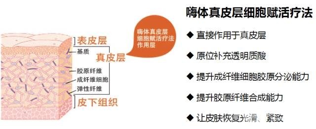 嗨体