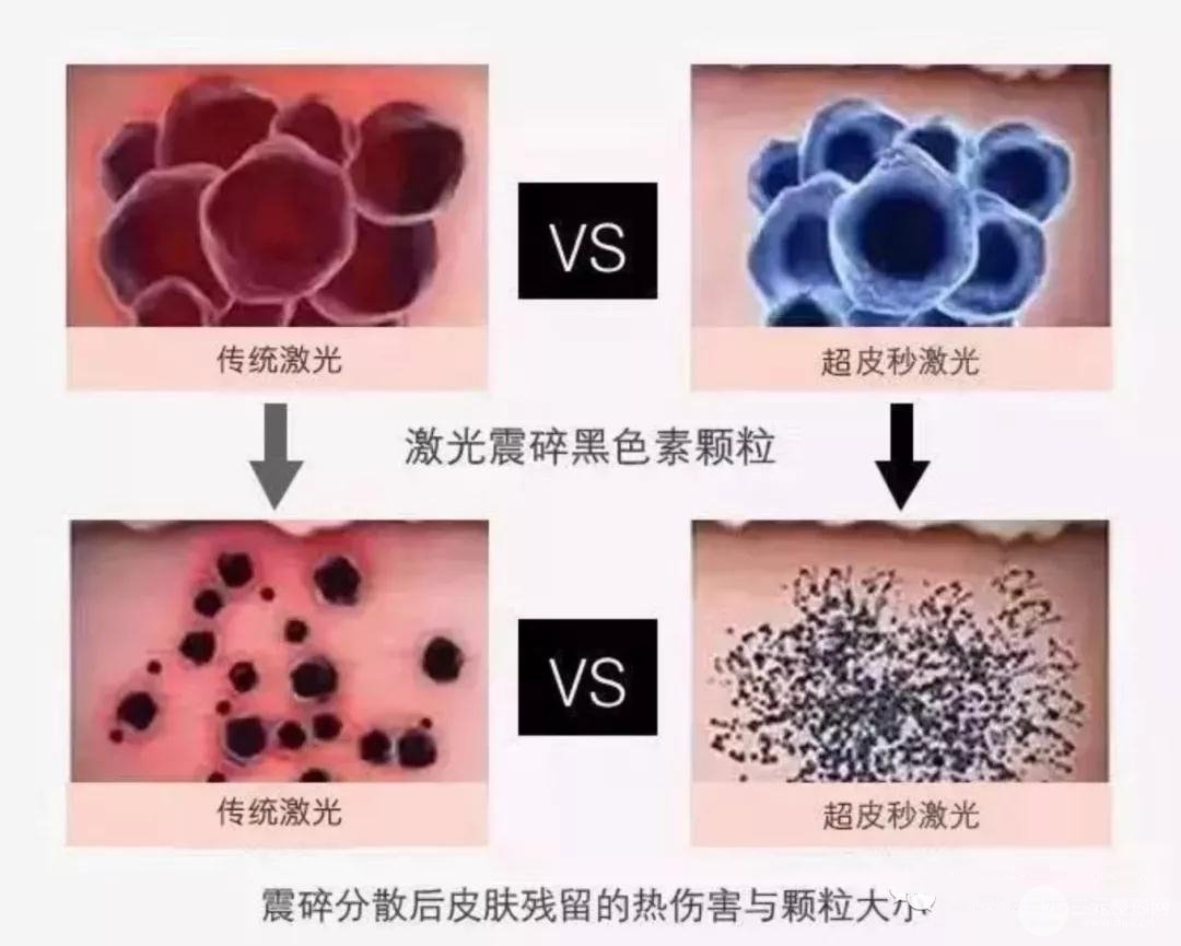 超蜂巢特点