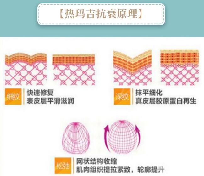 热玛吉