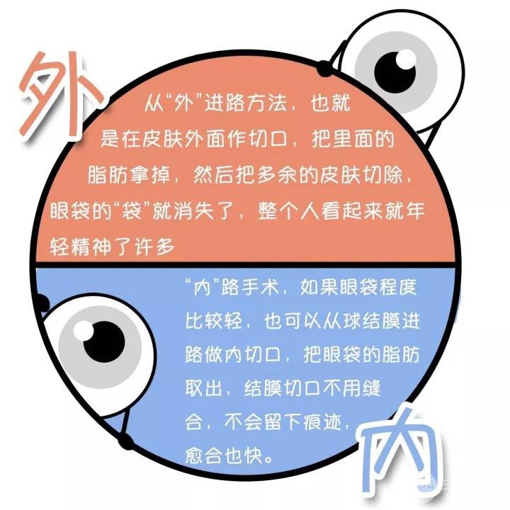 眼袋手术