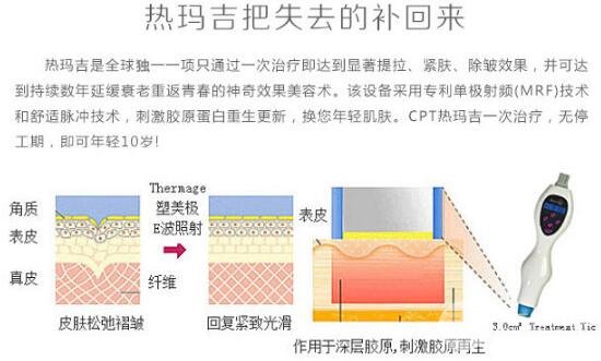 热玛吉