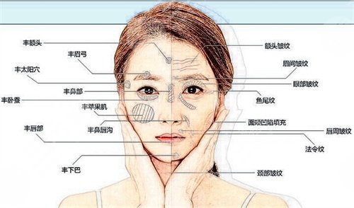 注射除皱术案例反馈术后果