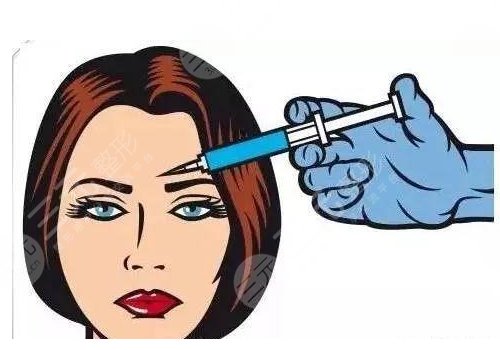 注射玻尿酸