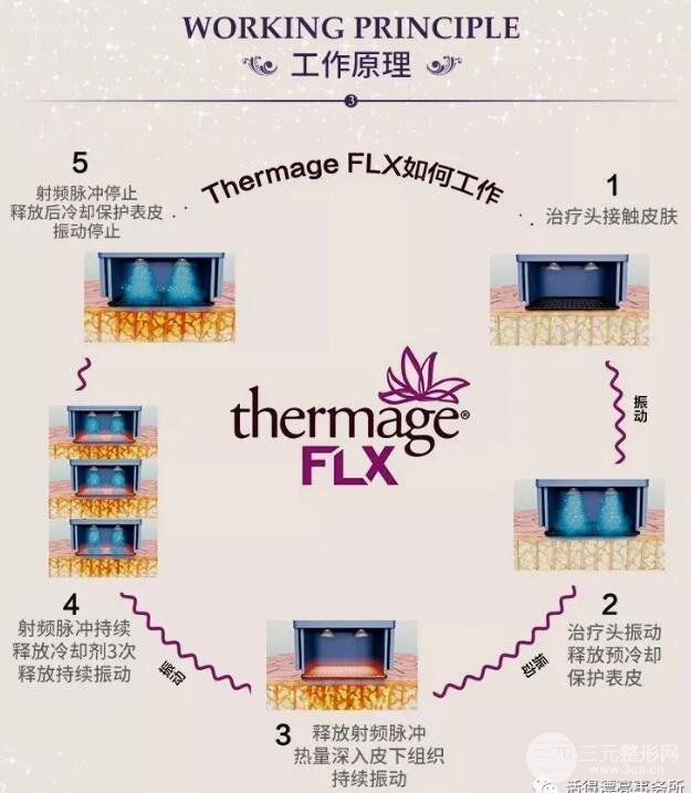 新一代热玛吉的原理和功