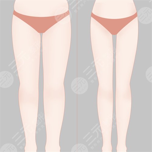 沈阳陆军总院吸脂谁做的好