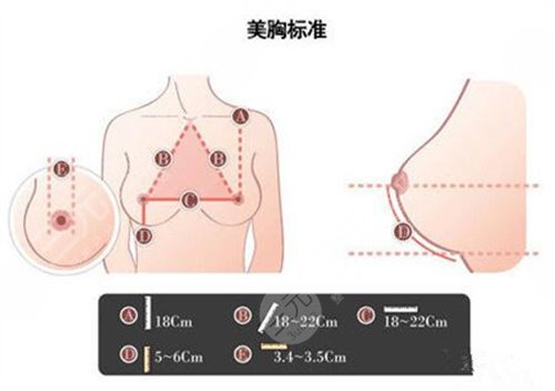 隆胸术后二个月