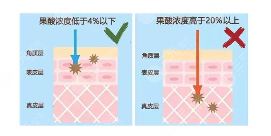 4问4答|让你更懂！新手必备干货~