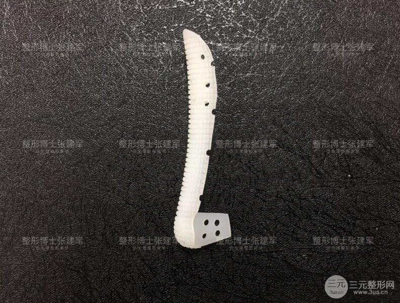 广州博仕整形医院雨沙假体隆鼻案例