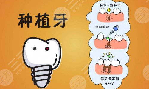 种植牙齿的价格影响因素