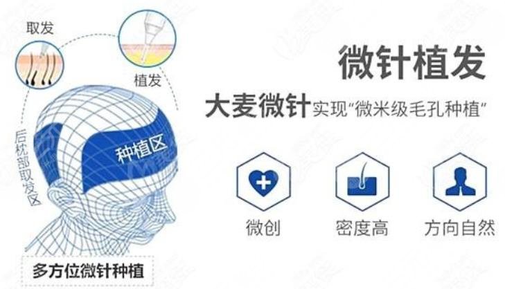 微针植发