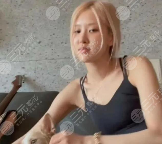 朴彩英整容变美经过历程：
