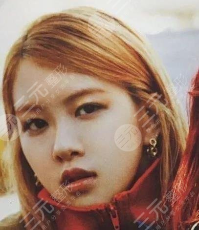 朴彩英整容变美经过历程：