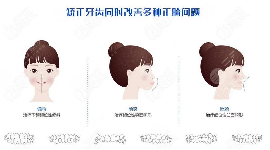 牙齿矫正