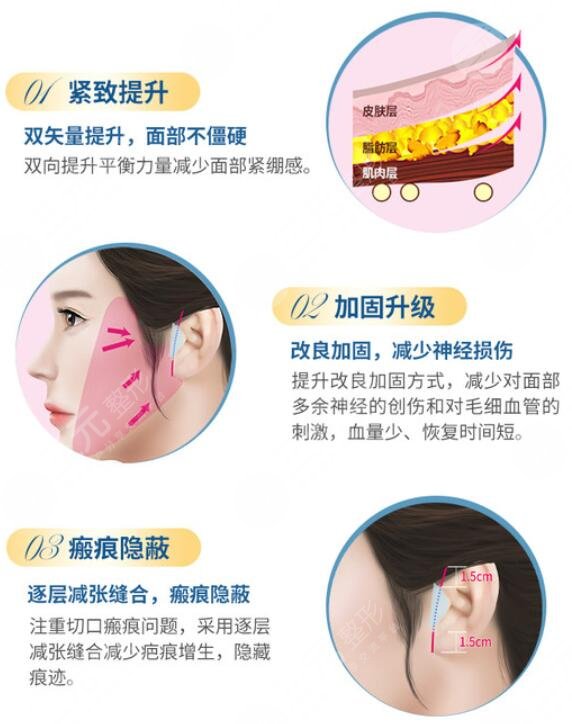 激光除皱