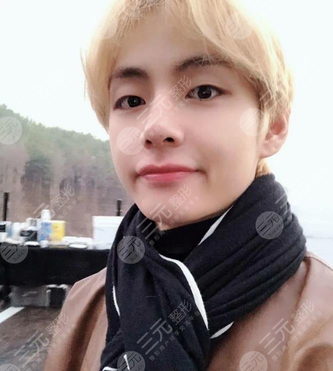 BTS金泰亨颜值有着哪些优点?