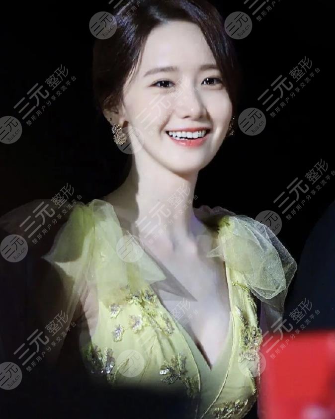 林允儿之所以“神颜”有哪些优势?