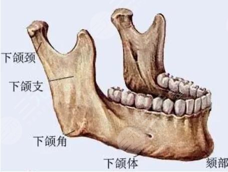 下颌角整形