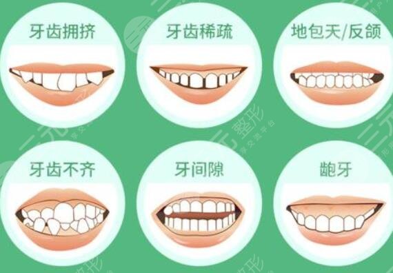 牙齿矫正