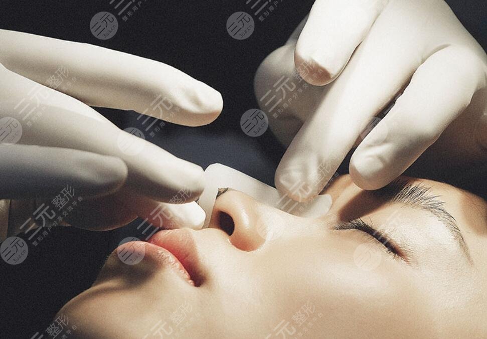 隆鼻术后应该怎么护理
