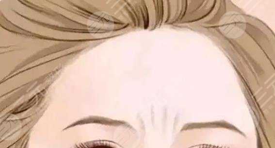 川字纹