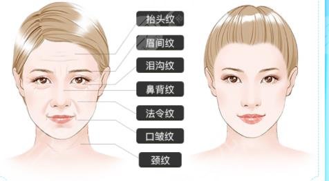 川字纹