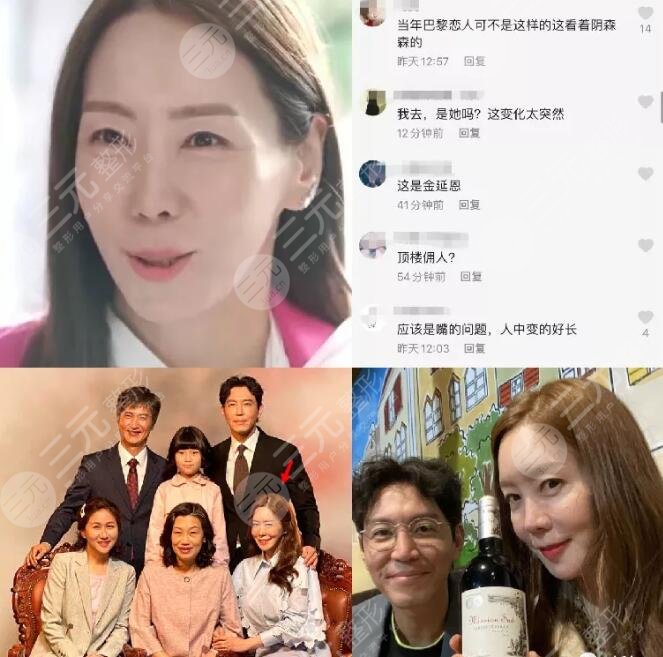 金廷恩