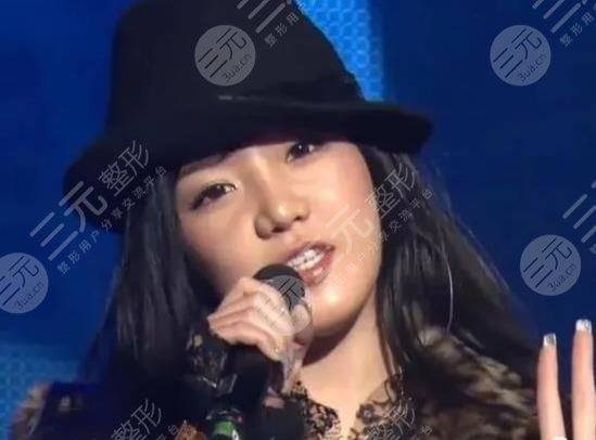 朴春变脸成“怪物”?她动了哪些地方?