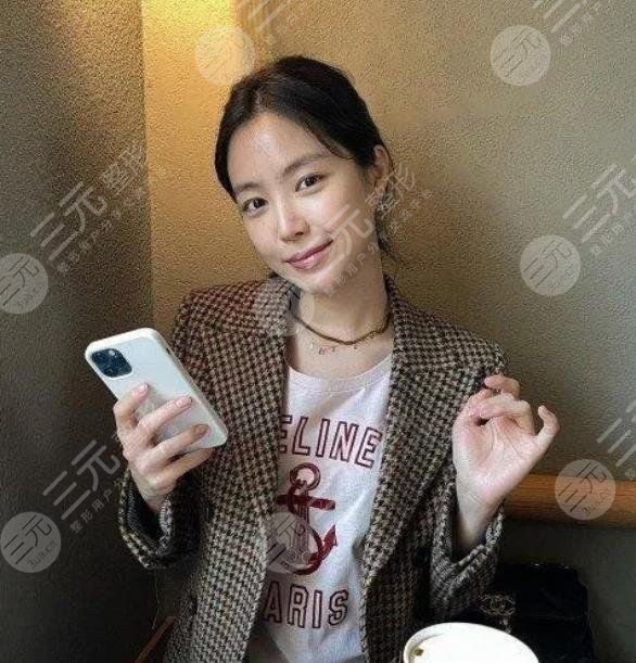 孙娜恩整容