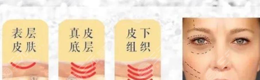 赛诺龙5gmax极速提拉