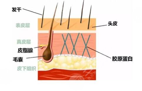 头皮清洁不到位