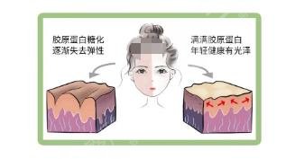 为什么要抗糖?