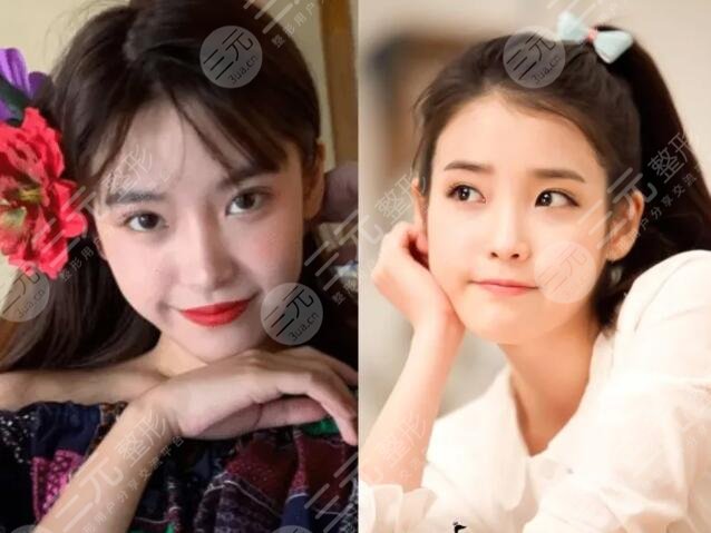 iu