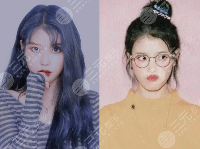 IU