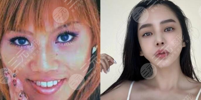 整后真的吓人vs整形成功的天选之人,到底差别在哪里?