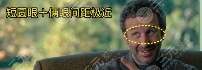 眼距近