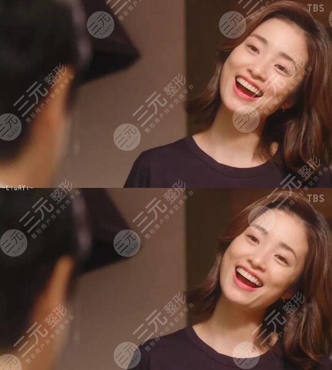 上户彩