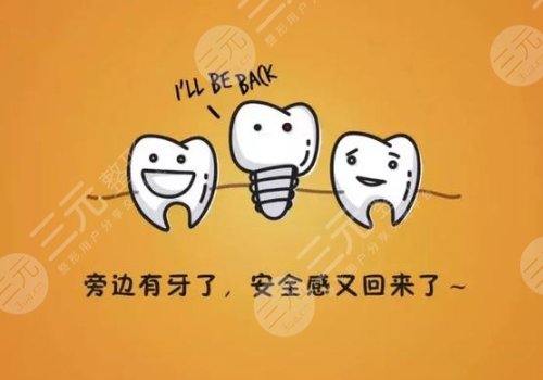 种植满口牙需要多长时间?
