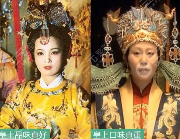 do脸天花板|整容的终端模板，原来长酱紫啊...
