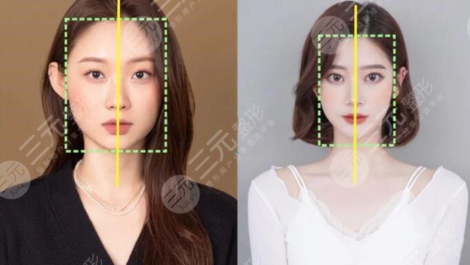 歪嘴、大小眼、脸歪的她，“高人指点”后，美貌奇袭！