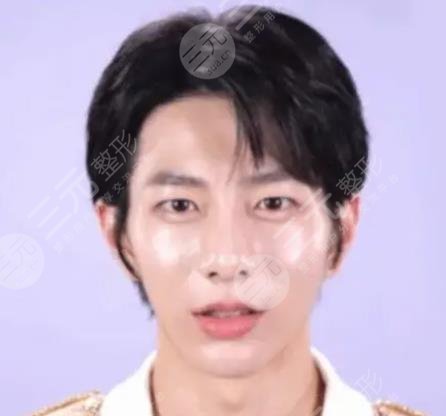 崔普闵整容盘点