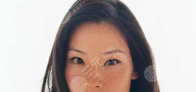 单眼皮不好看?