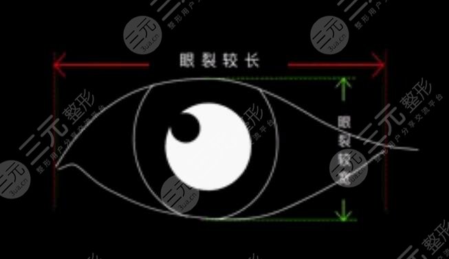 眼裂