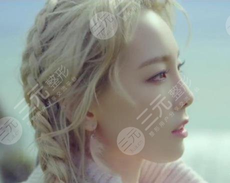 金泰妍整容了吗?