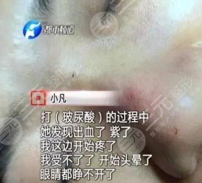 医美市场混乱