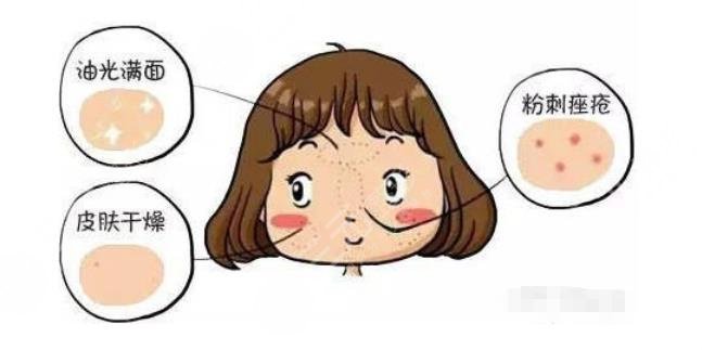 干货分享|干皮vs油皮、油痘肌VS油敏肌，四者如何区分？怎么改善？