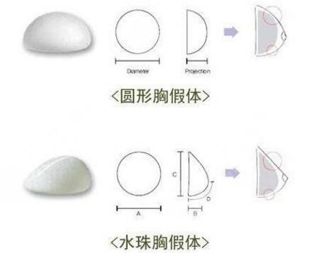 郑州美莱医疗美容医院科普硅胶隆胸