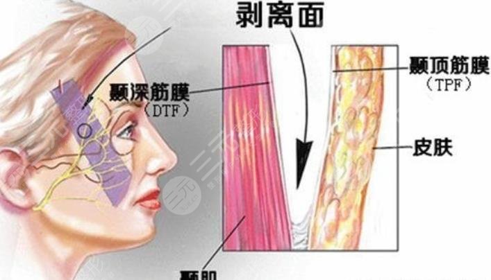 杭州小拉皮