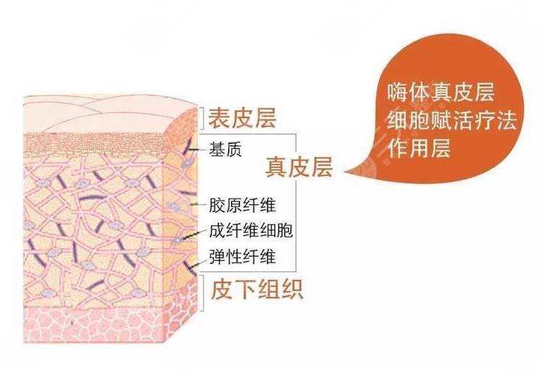 嗨体除皱相关知识科普