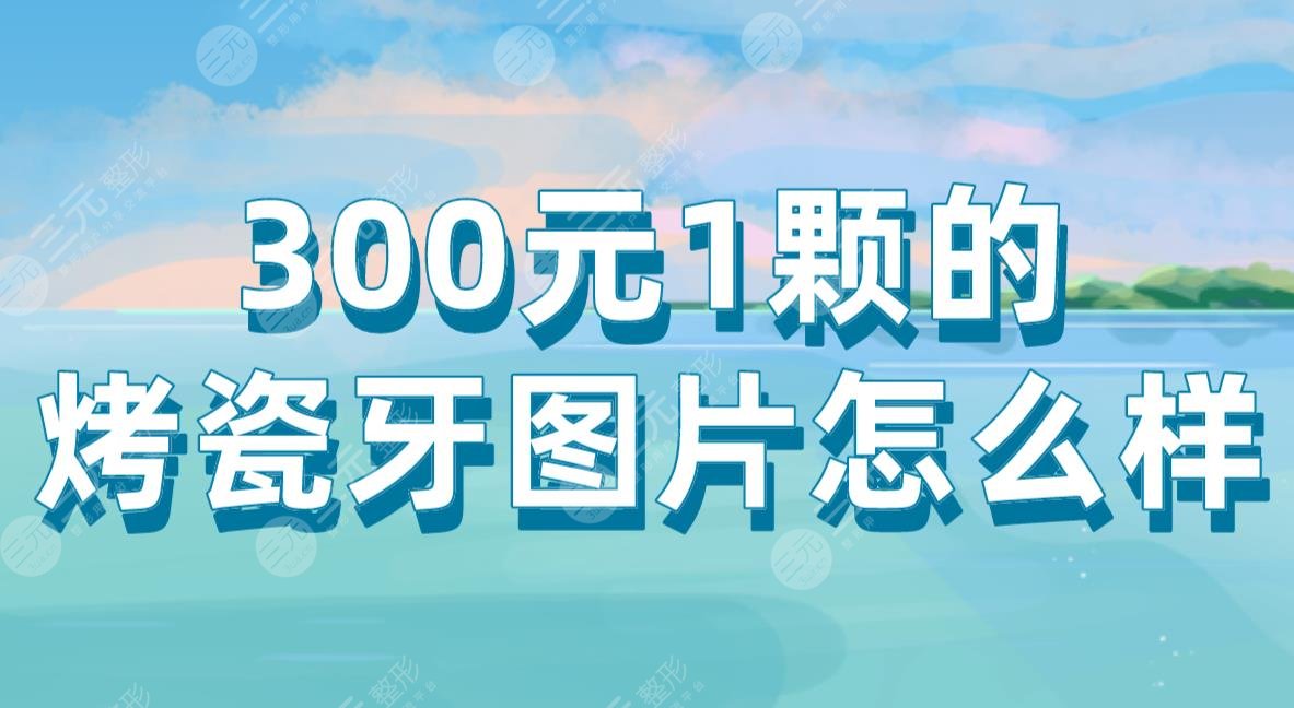 300元1颗的烤瓷牙图片怎么样？附烤瓷牙及全瓷牙对比+价格表